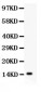 Anti-IL-15 Antibody