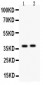 Anti-Calretinin Picoband Antibody