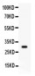 Anti-CD8 Alpha Picoband Antibody