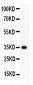 Anti-CD63 Picoband Antibody