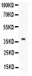 Anti-CD86/B7-2 Antibody