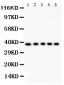 Anti-FAS Antibody