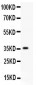 Anti-HIF-1-Alpha Picoband Antibody