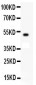 Anti-KIT/SCFR Antibody