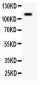 Anti-KIT/SCFR Antibody