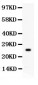 Anti-Kallikrein 3 Antibody