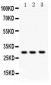 Anti-Kallikrein 3 Antibody