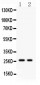 Anti-Kallikrein 4 Picoband Antibody