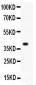 Anti-MCM7 Picoband Antibody