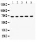 Anti-Menin Picoband Antibody