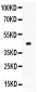 Anti-Mitofusin 1 Picoband Antibody