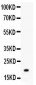 Anti-MGMT Picoband Antibody