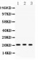 Anti-MGMT Picoband Antibody