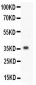 Anti-MMP-3 Antibody