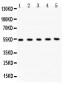 Anti-MMP-3 Antibody