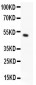 Anti-MSK1 Picoband Antibody