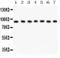 Anti-MSK1 Picoband Antibody