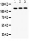 Anti-TRPC5 Picoband Antibody