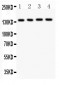 Anti-ABCB4 Picoband Antibody