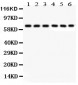 Anti-Kininogen-1/KNG1 Antibody