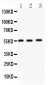 Anti-MMP-14 Antibody