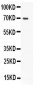 Anti-Mucin 5AC Picoband Antibody