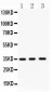 Anti-Nkx2.5 Picoband Antibody