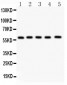 Anti-NR5A2/LRH1 Picoband Antibody