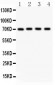 Anti-Neuregulin-1 Antibody
