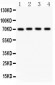 Anti-Neuregulin-1 Antibody