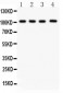 Anti-Neuropilin-1 Antibody