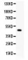 Anti-P2X5 Picoband Antibody