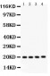 Anti-PARK7/DJ1 Picoband Antibody