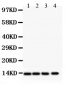 Anti-PDGF-BB Antibody