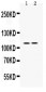 Anti-PIK3CA Picoband Antibody