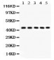 Anti-PIM1 Picoband Antibody