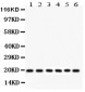 Anti-Pin1 Picoband Antibody