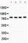 Anti-PKC Alpha Picoband Antibody