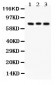 Anti-PKC Beta 1 Picoband Antibody