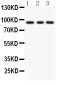 Anti-PKC Epsilon Picoband Antibody