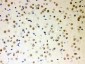 Anti-PKC Iota Picoband Antibody