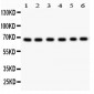 Anti-PKC Iota Picoband Antibody