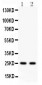 Anti-Rab3A Picoband Antibody