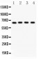 Anti-NF-kB p65 Picoband Antibody