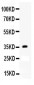 Anti-APOE Antibody