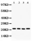 Anti-ATP5H Picoband Antibody