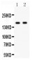 Anti-NMDAR2A Picoband Antibody