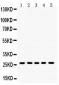 Anti-ERAB Antibody Antibody