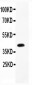 Anti-APPBP1 Picoband Antibody