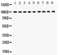 Anti-NR3C1 Picoband Antibody